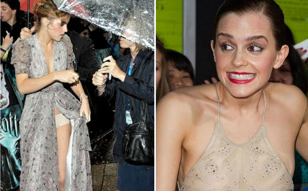 emma-watson-acidentes Reprodução/Twitter