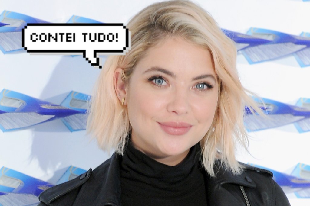 Ashley Benson revela seus maiores truques contra a acne