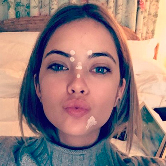 ashley-benson-espinhas (Instagram)