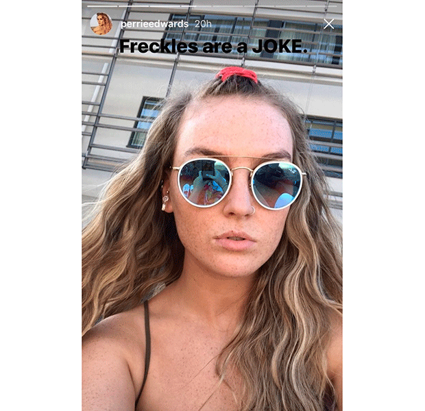 perrie edwards sem maquiagem sardas