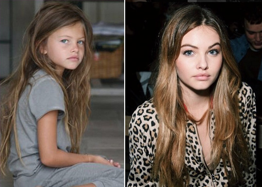 antes-depois-menina-mais-bonita-do-mundo