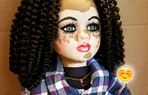 Artista cria bonecas com vitiligo e encomendas estão bombando!