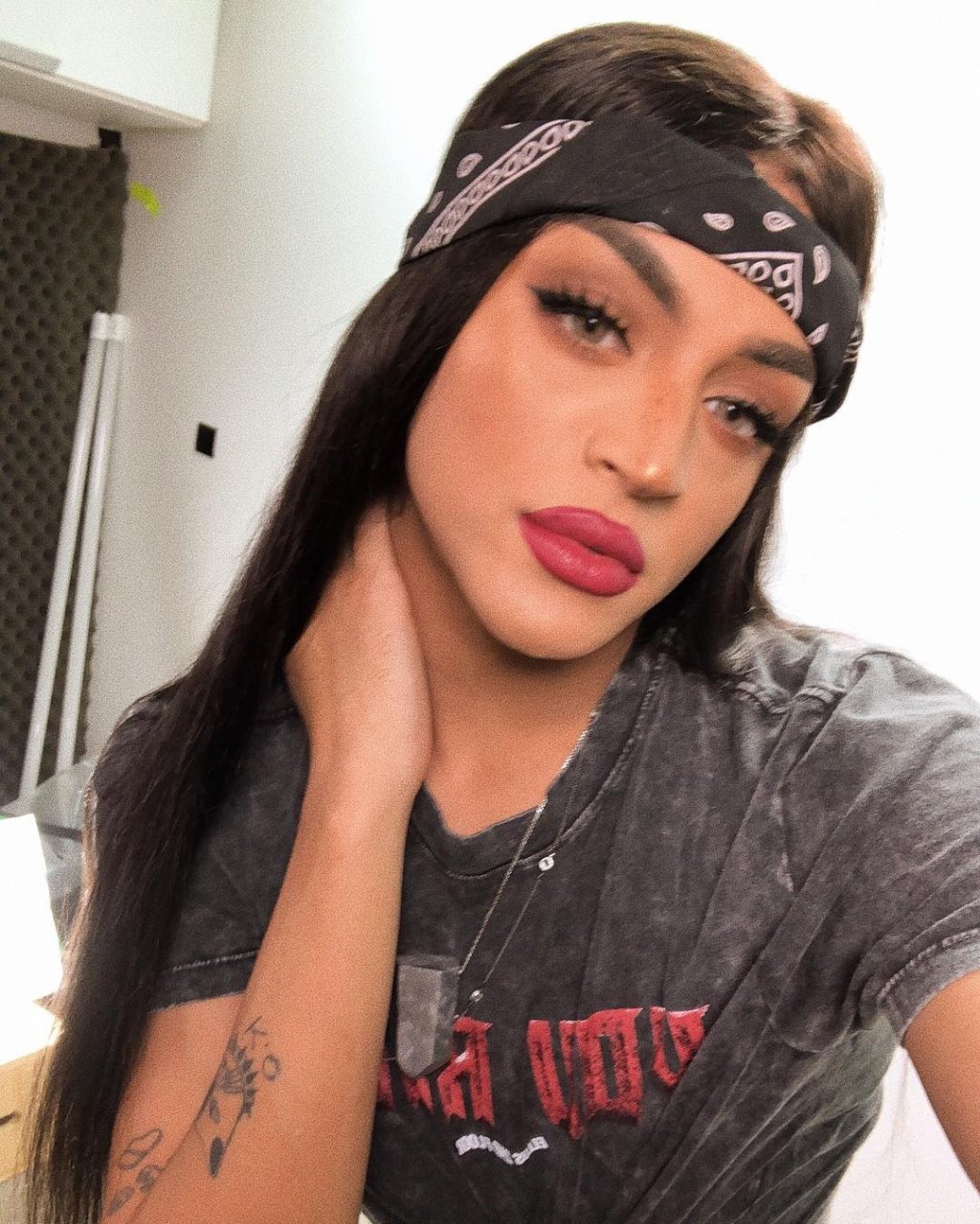 Pabllo Vittar posta foto com curativos após cirurgia no nariz