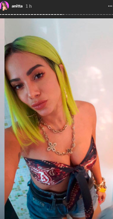 anitta-cabelo-amarelo-2 anitta-cabelo-amarelo