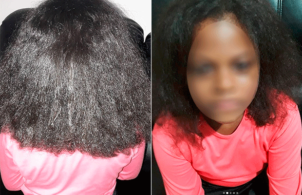 Menina que teve cabelo alisado à força está sofrendo bullying na escola
