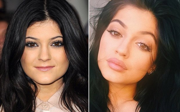 boca-kylie-jenner-maquiagem-preenchimento56100