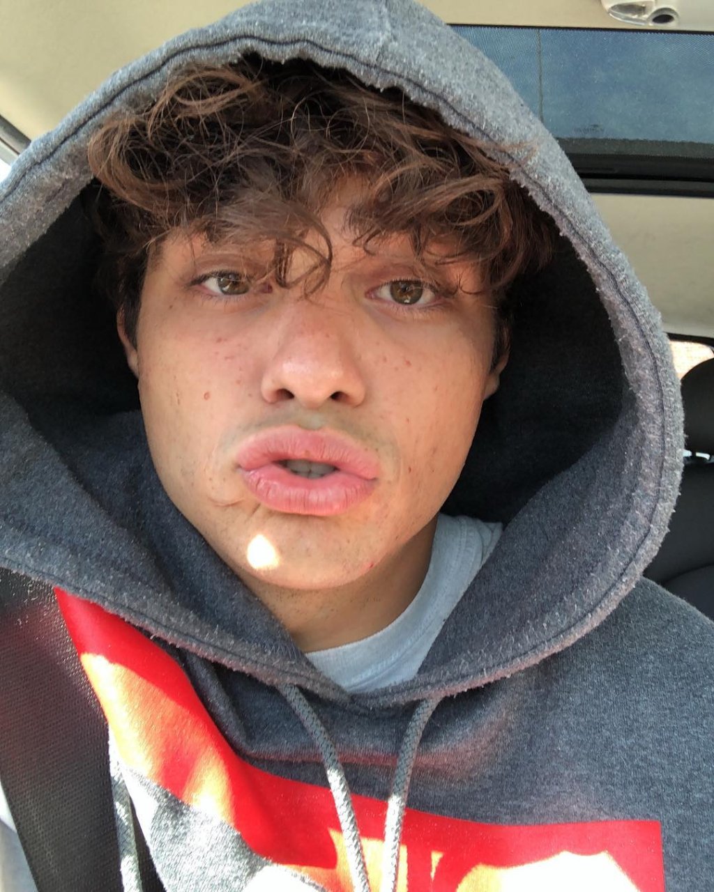 Noah Centineo revela por que tem aquela cicatriz perto do queixo