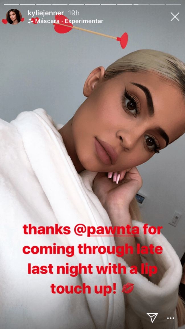 kylie-jenner-preenchimento-labial kylie-jenner-preenchimento-labial