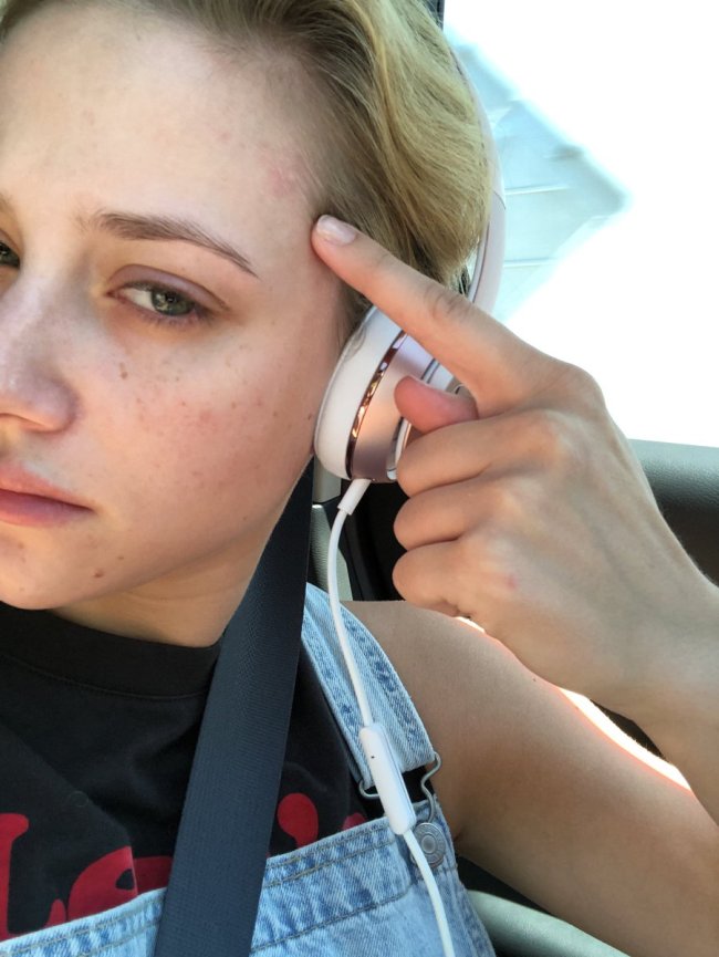 lili-reinhart-espinhas-acne lili-reinhart-espinhas-acne