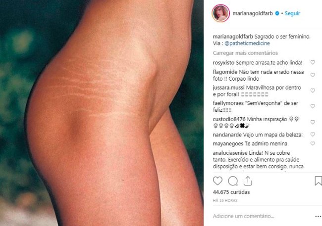 mariana-goldfarb-estrias-corpo mariana-goldfarb-estrias-corpo