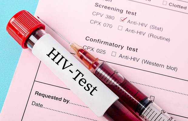 O desserviço das fake news no combate contra a Aids