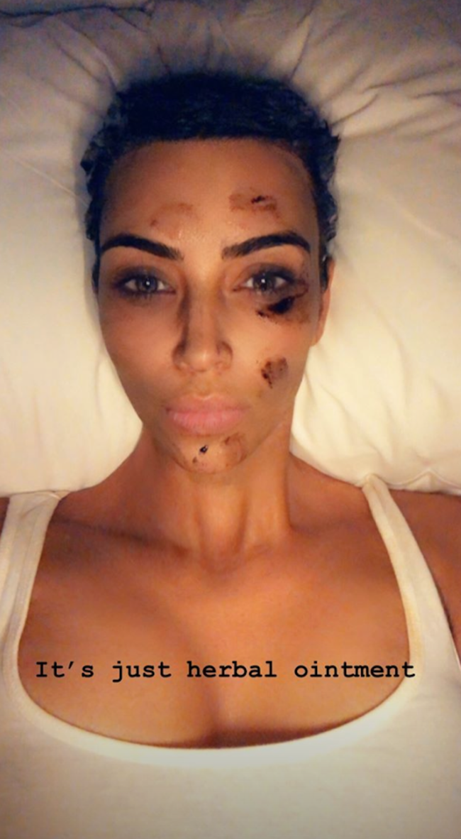 kim-kardashian-psoriase-1 kim-kardashian-psoriase-1