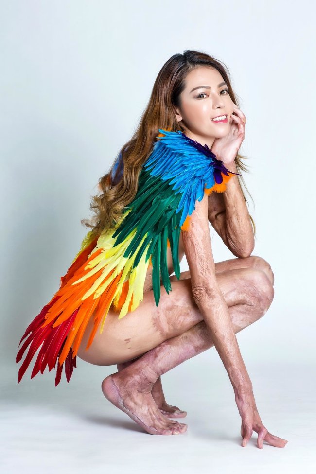 lia-jiang-queimadura-foto-nu1 lia-jiang-queimadura-foto-nu1