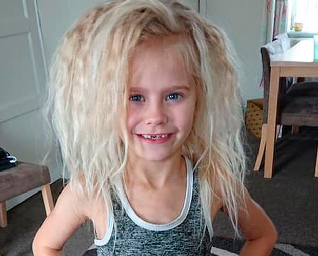 Wynter-Seymour-sindrome-cabelo-impeteavel Wynter-Seymour-sindrome-cabelo-impeteavel