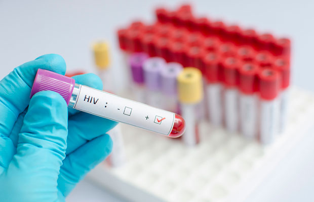 Pela 1ª vez, cientistas conseguem remover o vírus HIV de genomas!