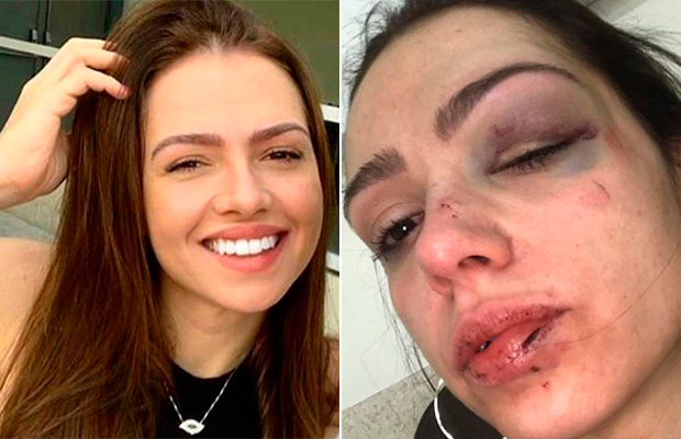Mulher relata que foi espancada em famosa casa de shows de São Paulo
