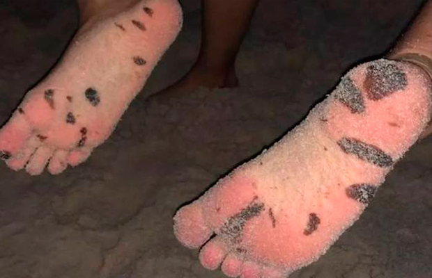 Dossiê “Óleo no Nordeste”: das praias poluídas às pessoas intoxicadas