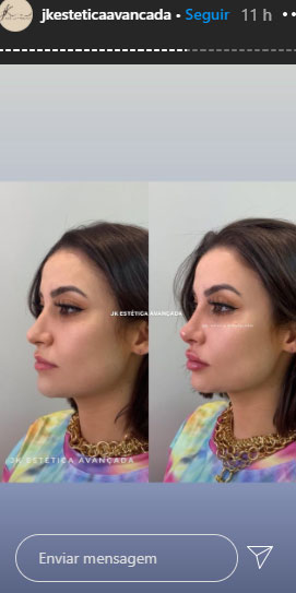 bianca-andrade-procedimentos-esteticos-2 bianca-andrade-procedimentos-esteticos-2