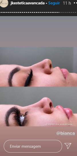 bianca-andrade-procedimentos-esteticos-3 bianca-andrade-procedimentos-esteticos-3