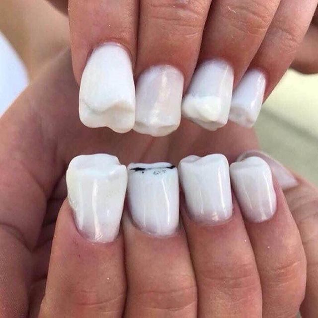 Foto com destaque nas unhas que estão com nail art inspirada em aparelho dentário