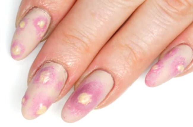 Foto com destaque nas unhas que estão com nail art inspirada em aparelho dentário