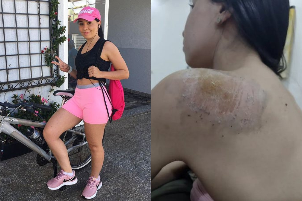 À esquerda, a ciclista antes de sair para pedalar, toda feliz. À direita, ela na volta, cheia de machucados na pele.