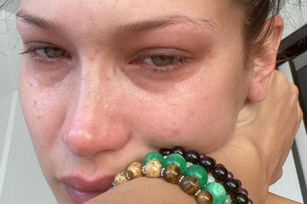 Bella Hadid faz desabafo sobre saúde mental: “Redes sociais não são reais”