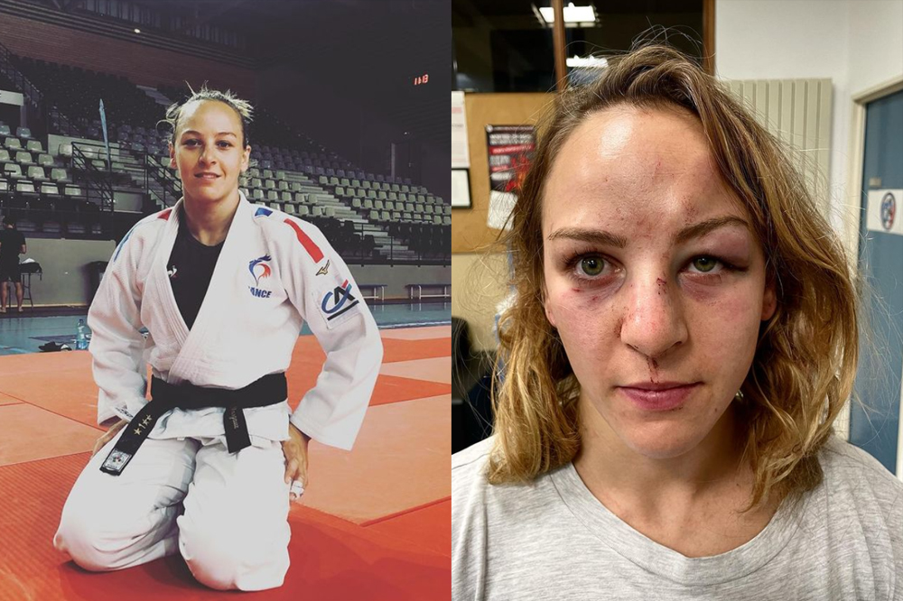 Judoca francesa acusa namorado de violência doméstica e lamenta impunidade