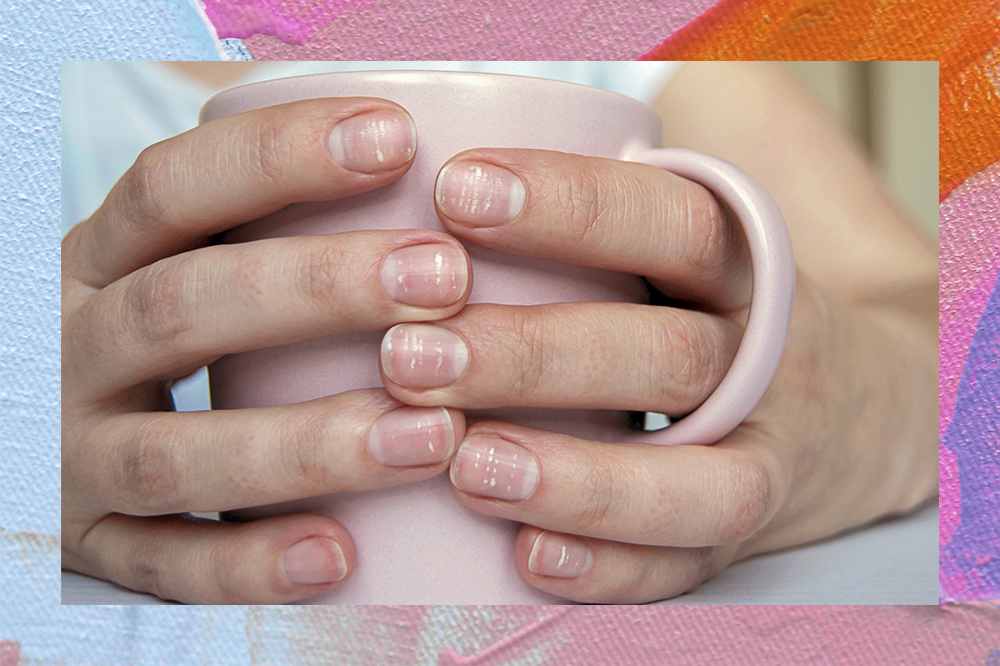 Montagem em fundo azul, rosa e laranja com foto de mãos segurando uma caneca e unhas com manchas brancas, chamadas de leuconíquia