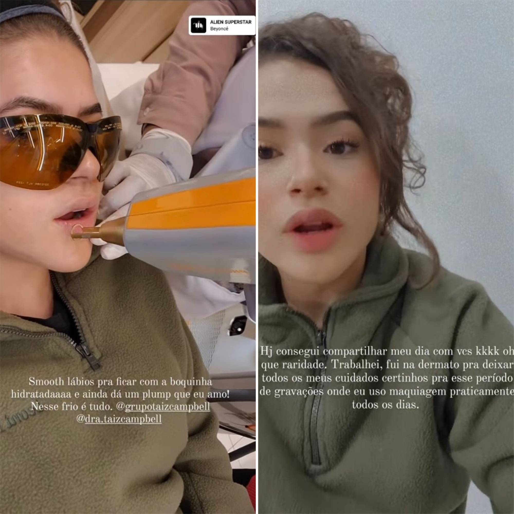 maisa-silva-cuidados-pele Montagem com dois Stories da Maisa Silva contando que foi a dermatologista para cuidar da pele