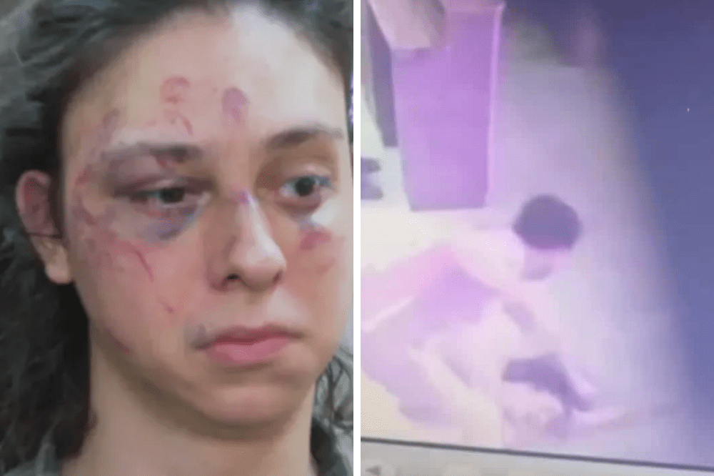 Ator Victor Meyniel é espancado em portaria no RJ; defesa alega homofobia